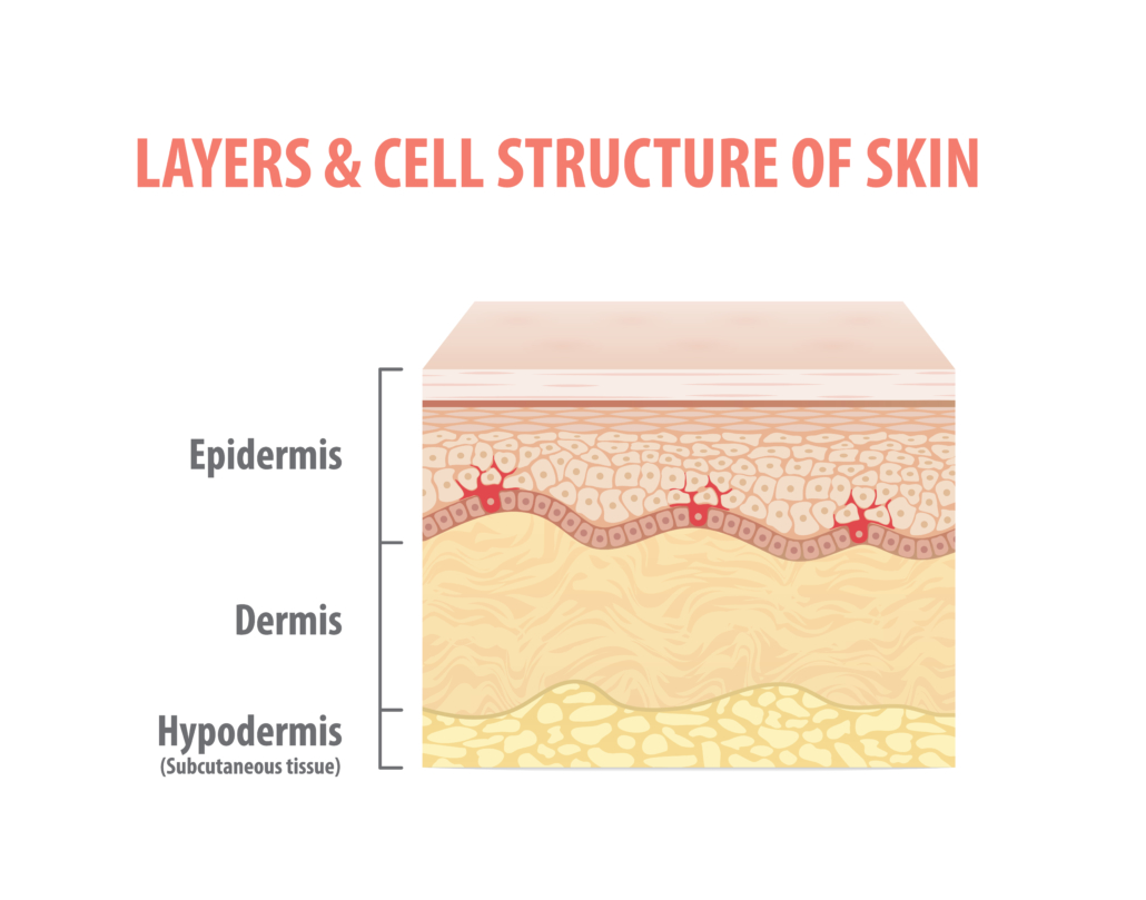 Burn Injury Classification - Explosion Burn Lawyer